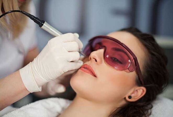 Laserska biorevitalizacija