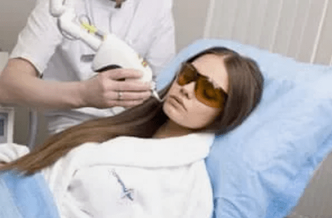 frakcijsko lasersko pomlajevanje